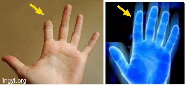 走进场生命世界 第四章 场生命的辉光现象证明场生命存在