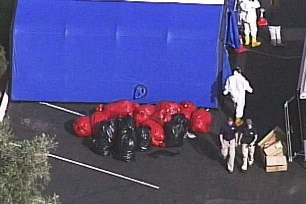 现实版人肉铺，女头缝在男人身上......