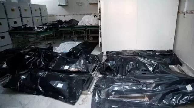 现实版人肉铺，女头缝在男人身上......