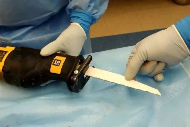 现实版人肉铺，女头缝在男人身上......