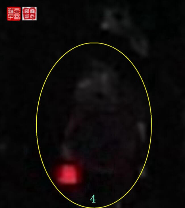 街边灵异这盏灯