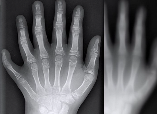 真实经历之56:六指女尸