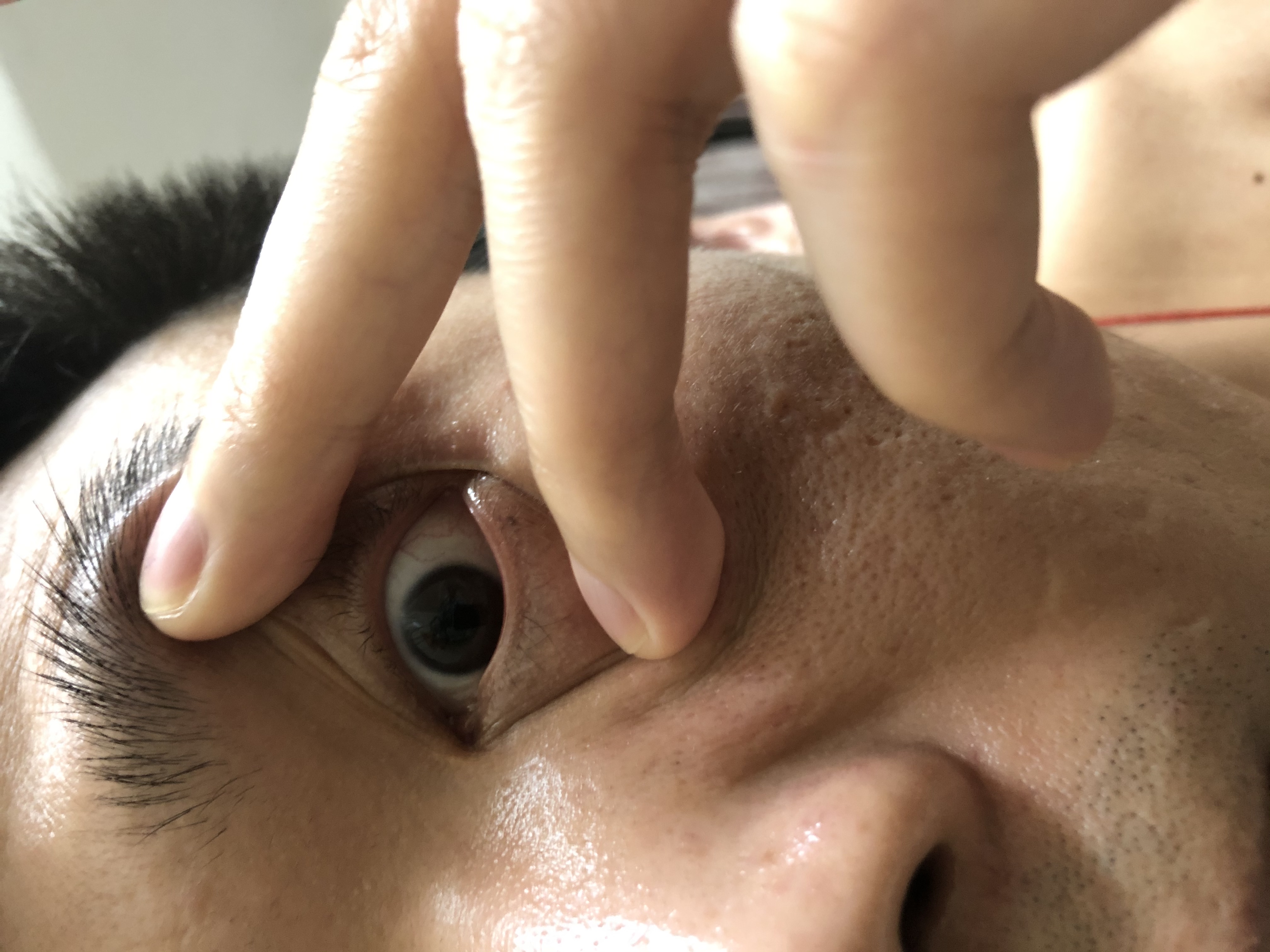 请懂的师傅帮忙看看眼睛红线有没有问题，谢谢