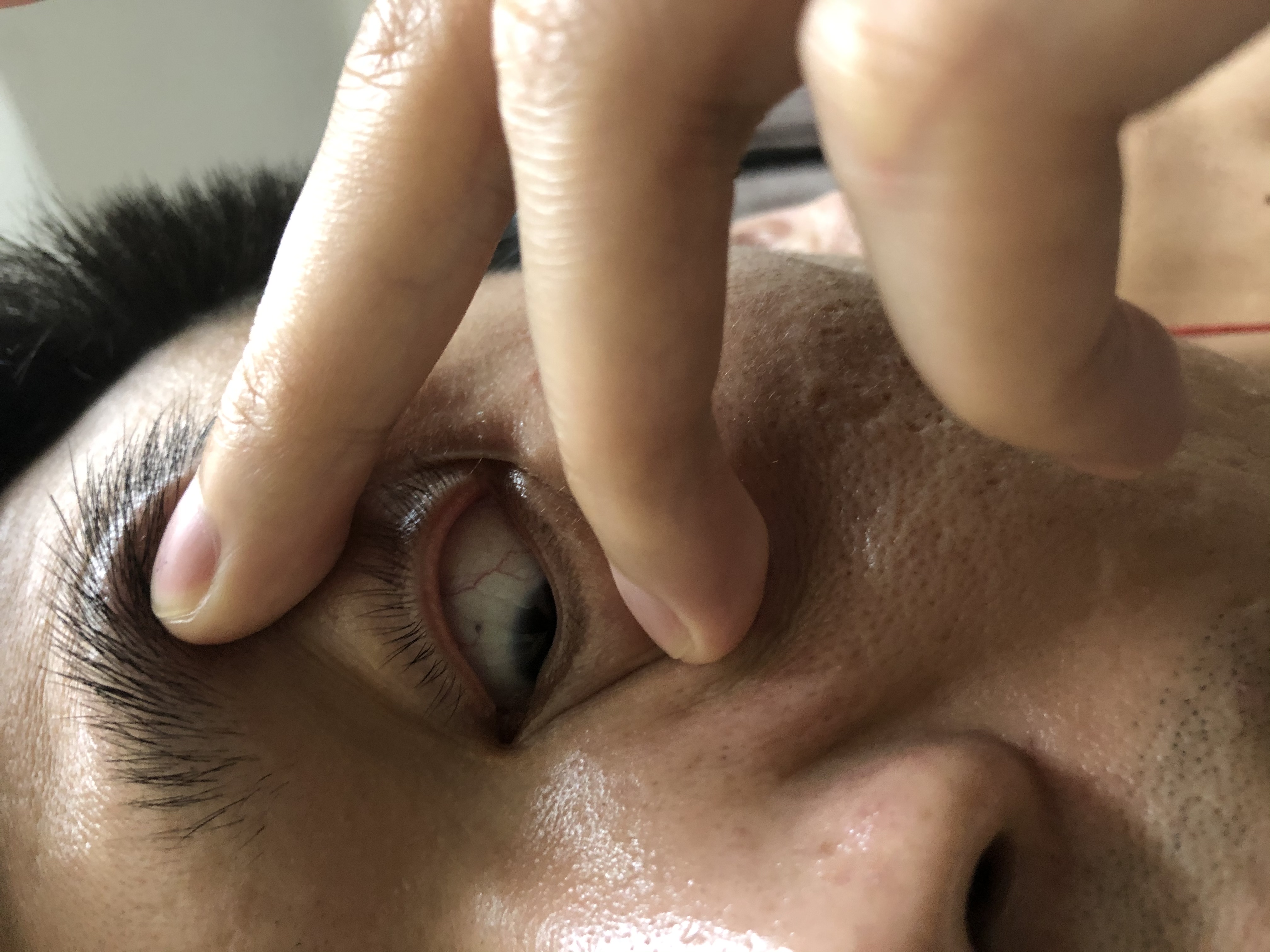 请懂的师傅帮忙看看眼睛红线有没有问题，谢谢