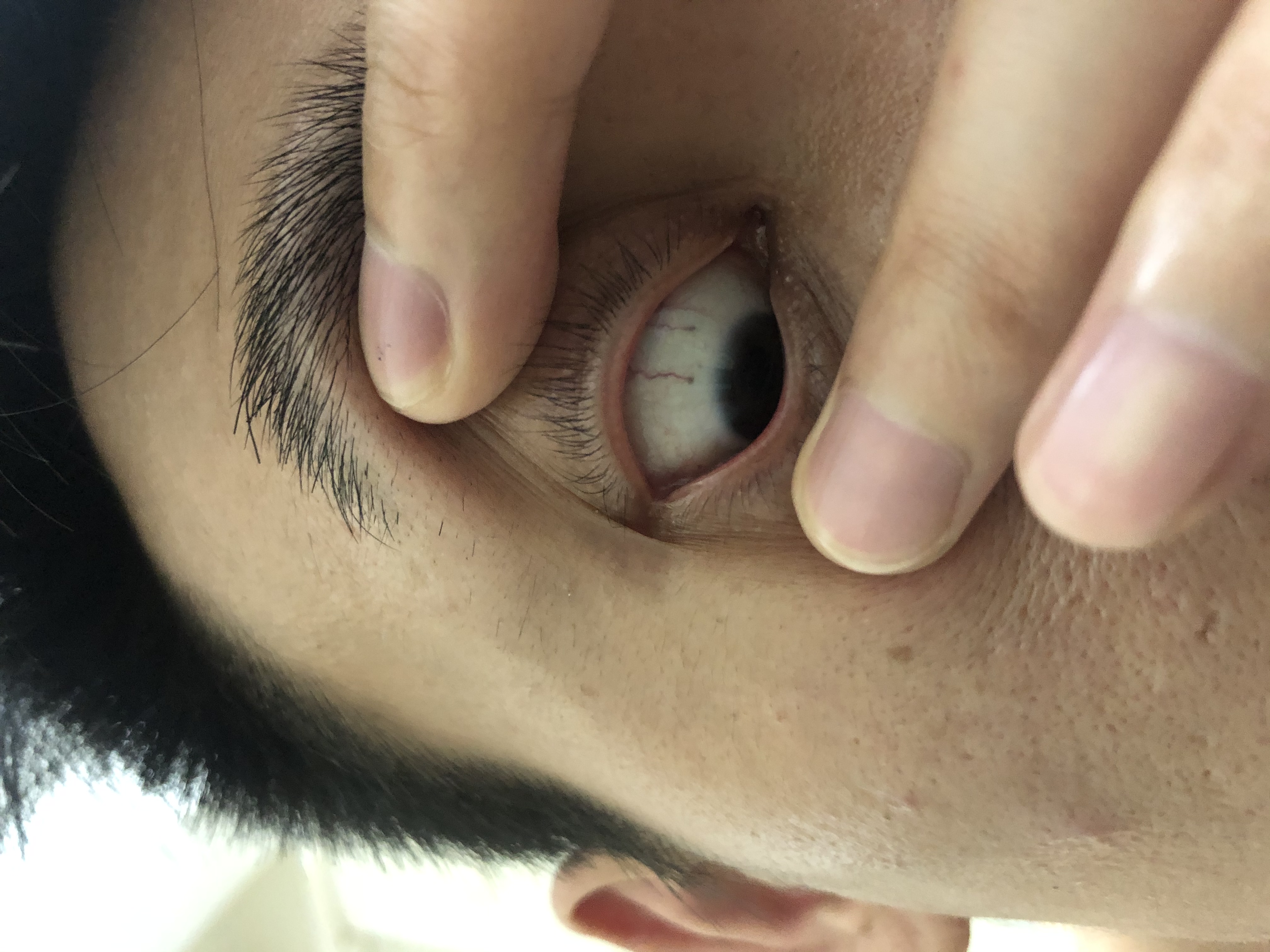 请懂的师傅帮忙看看眼睛红线有没有问题，谢谢