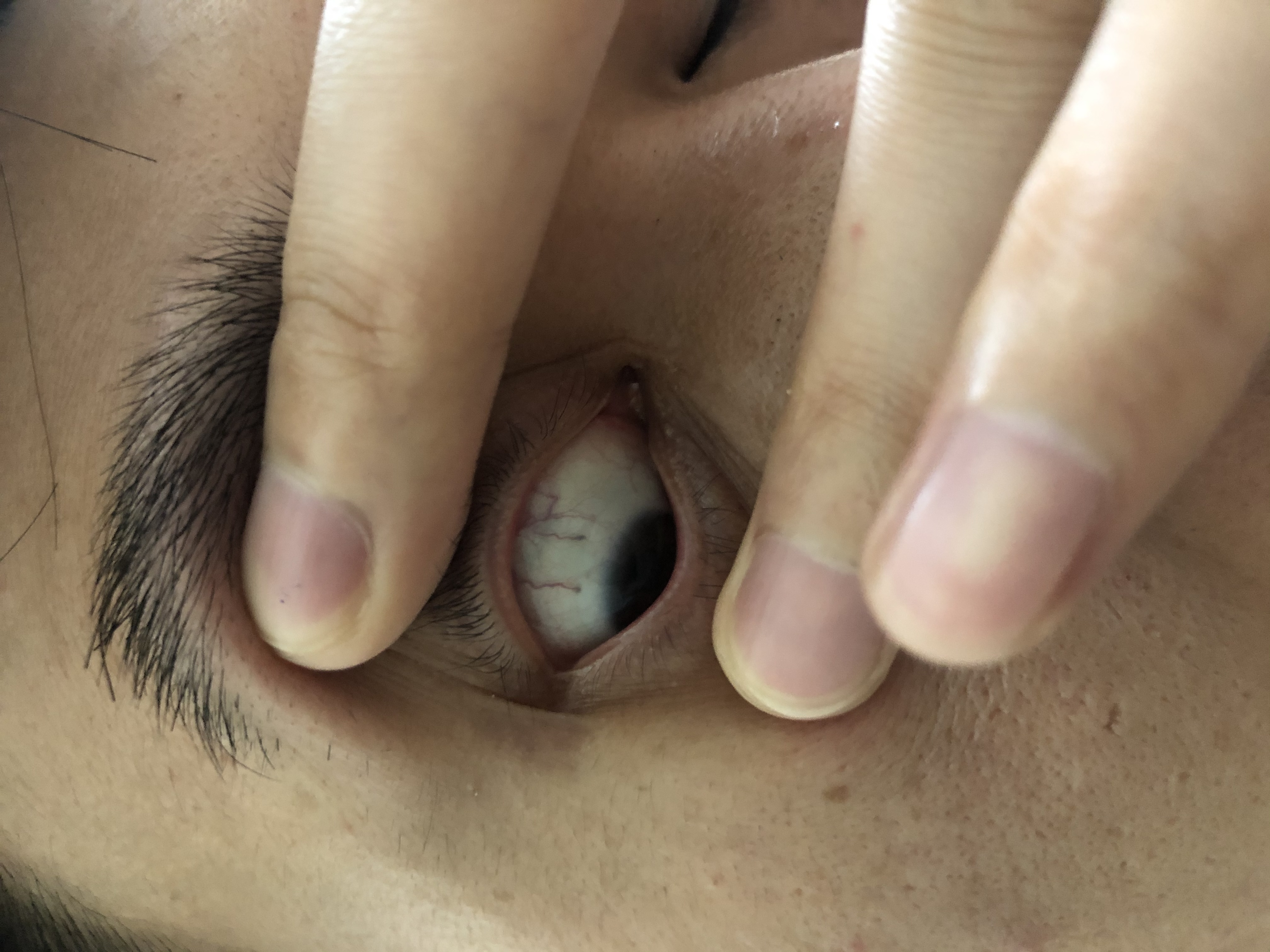 请懂的师傅帮忙看看眼睛红线有没有问题，谢谢