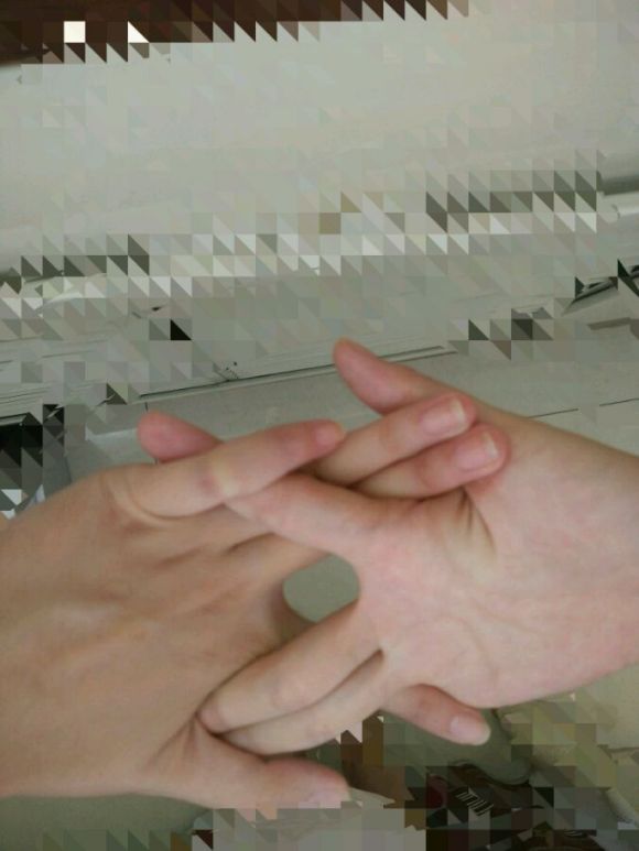 大家敢不敢试一试这个“狐狸之窗”？