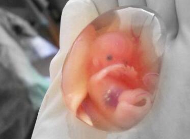 婴灵的危害是什么？婴灵缠身的表现有哪些？