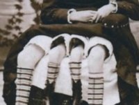 恐怖的美国老照片,竟然有4条腿的双胞胎