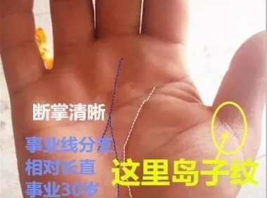 手相“这儿”岛子纹，是福不是祸，后半生金钱不断，跳过越福厚！