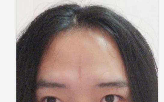 科普一下什么是天眼