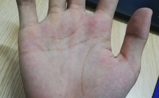 有会看手相的嘛,生命线短是不是命会比较短